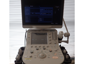 超音波診断装置